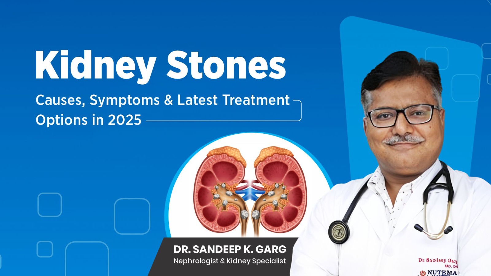 Kidney Stone Treatment in Meerut
